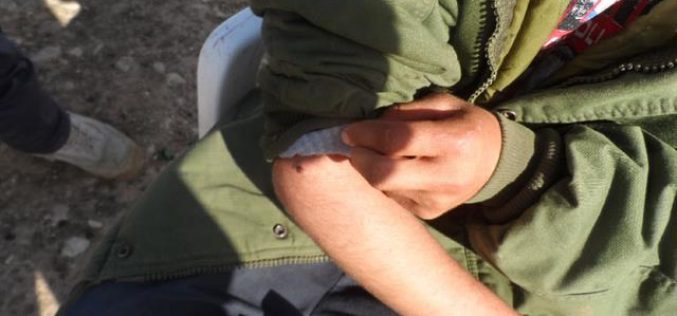 طفل آخر ضحية جديدة من ضحايا مخلفات التدريبات العسكرية الإسرائيلية في واد المالح – الأغوار الشمالية / محافظة طوباس