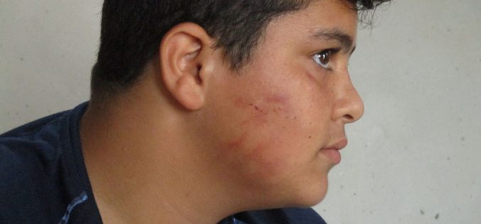 Israeli colonists assault Palestinian kid in Burqa village