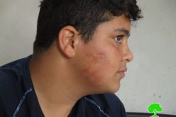 الاعتداء على طفل بالضرب المبرح من قبل المستعمرين في قرية برقة