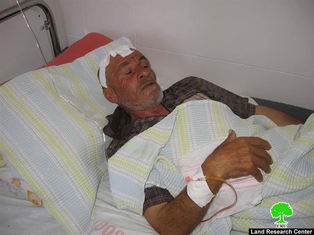 مستعمرون يهاجمون مزارعاً ويعتدون عليه بالضرب شرق يطا