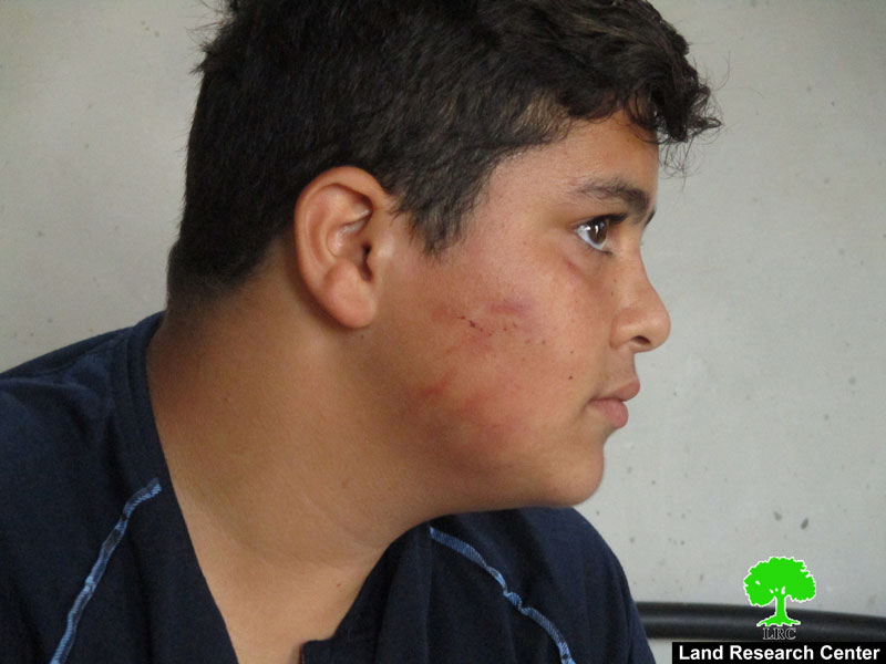 الاعتداء على طفل بالضرب المبرح من قبل المستعمرين في قرية برقة