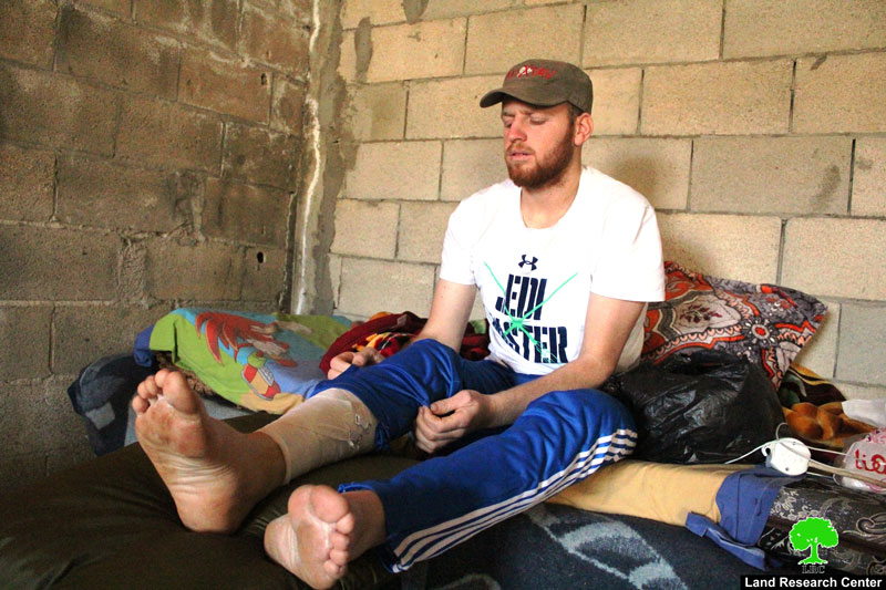 مستعمر يدهس شابا من قرية التواني جنوب الخليل