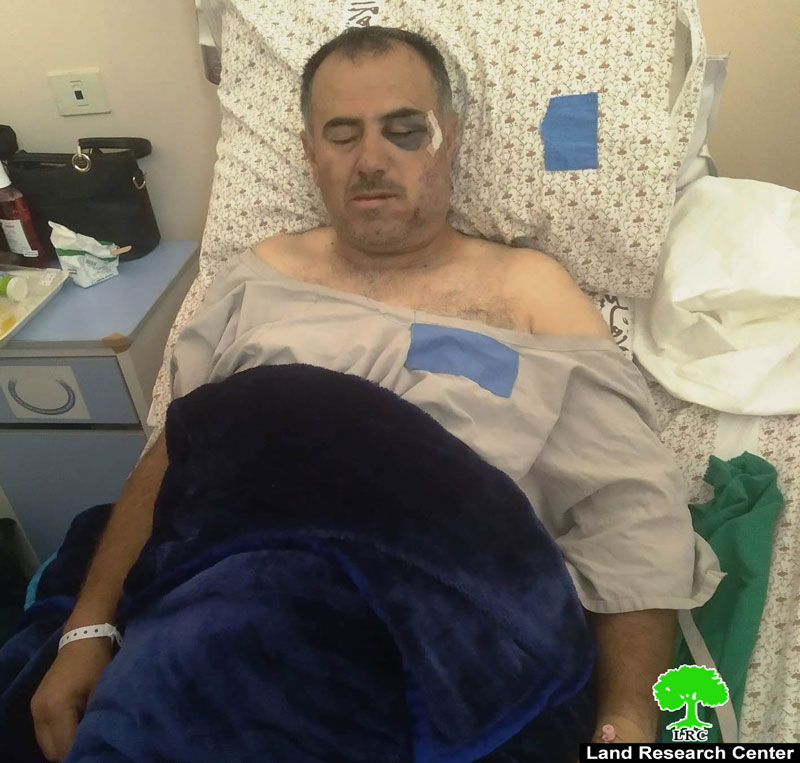 مستعمرون يهاجمون عائلة عوض ويعتدون عليهم بالضرب في شعب البطم جنوب الخليل